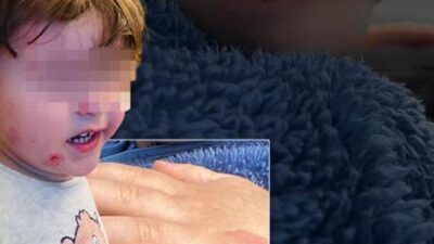 Özel kreşte skandal olay! 2,5 yaşındaki çocuk darp edildi