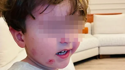 Kreşe bıraktığı çocuğunu darp edilmiş olarak geri aldı!